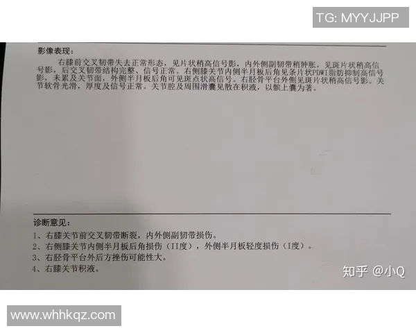 足球明星前交叉韧带重建手术的康复之路与运动生涯的影响分析